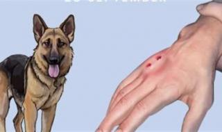 منظمة الصحة العالمية: بلاغات بشأن تفشي داء الكلب المميت بين البشر في هذه المنطقة